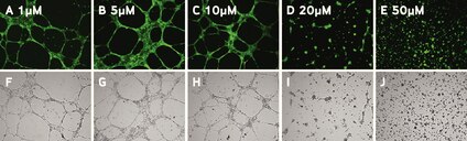 Increasing concentrations of sulforaphane resulted in both mean tube length and mean number of branch points as shown below in bright field and calcein-AM micrographs of HUVEC cells.